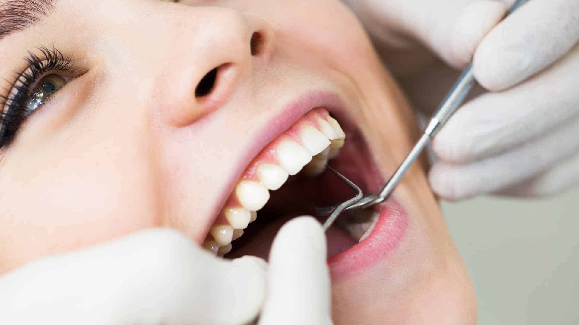 Zahnbeschwerden Karies Behandlung