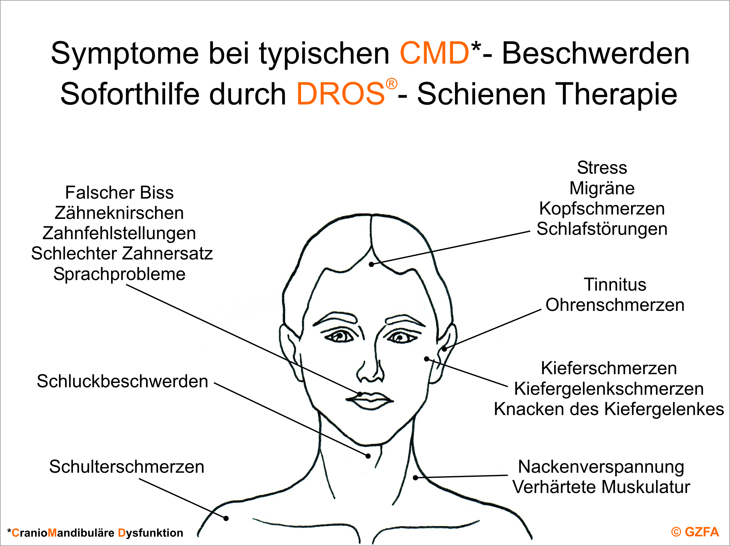 Berlin KU64, Grafik Symptome bei typischen CMD-Beschwerden, DROS-Schienen Therapie