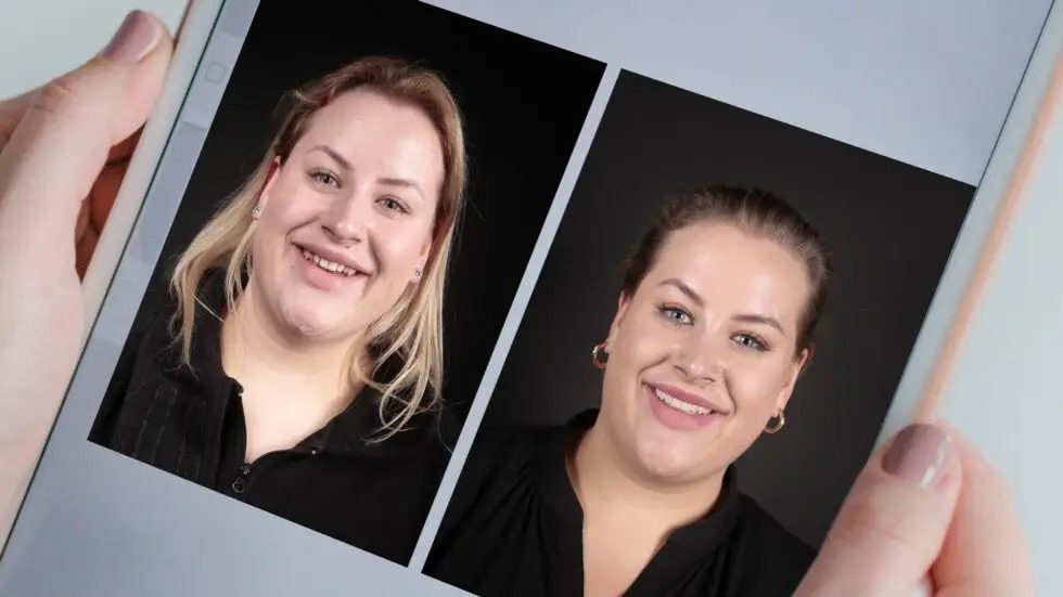 Vorher-Nachher-Vergleich einer erfolgreichen Digital Smile Design-Behandlung bei KU64.