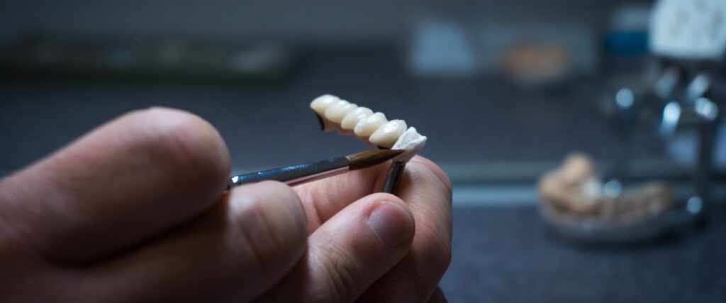 Zahnersatz-Implantat von dem Zahnlabor von KU64