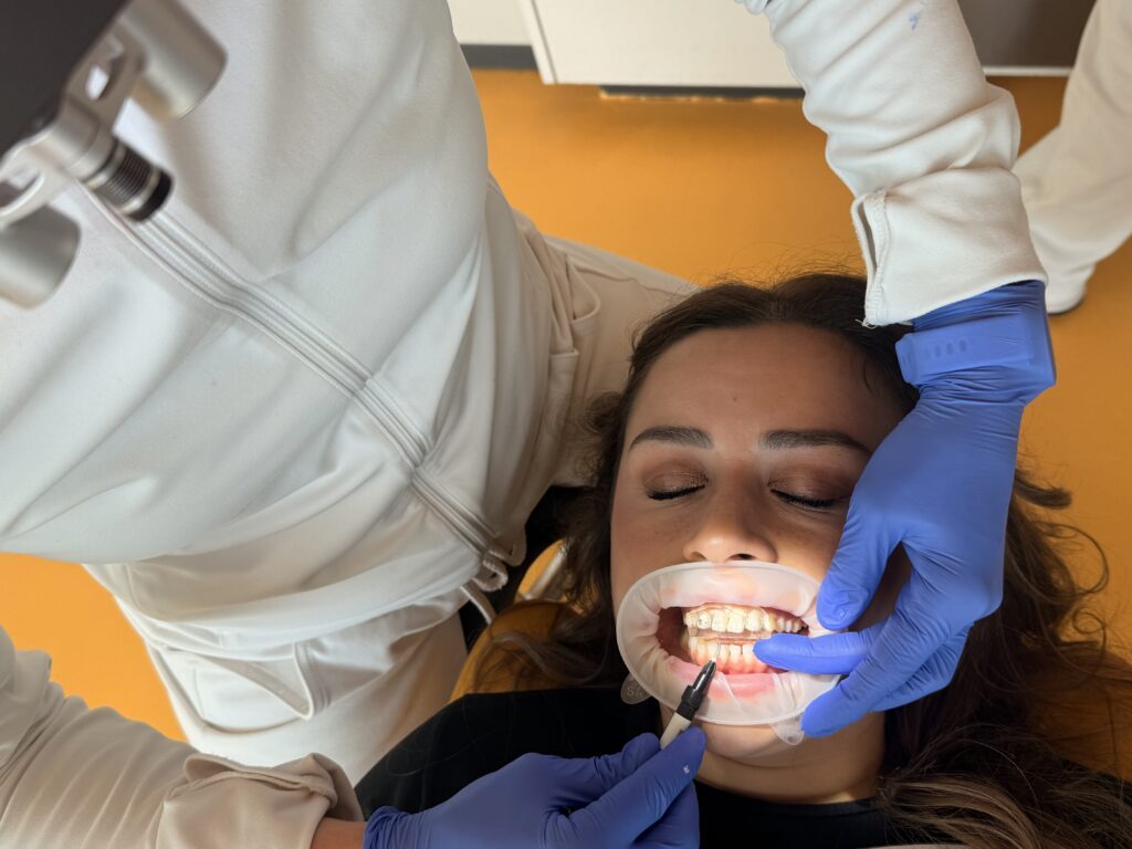 Behandlung der Zähne mit Flowable Injection Technique © KU64